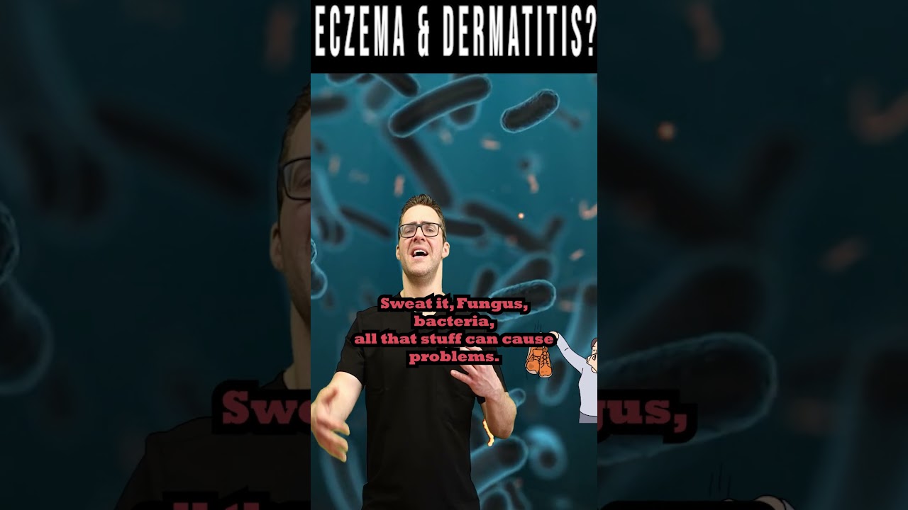 eczema dermatitis sufferers watch this