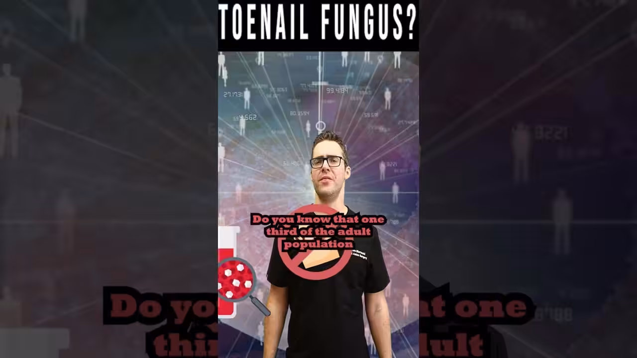 Toenail Fungus: The Real Cause And Cure | Balance Foot & Ankle