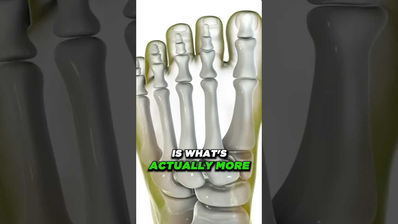 do bunion correctors work how to shrink bunions naturally