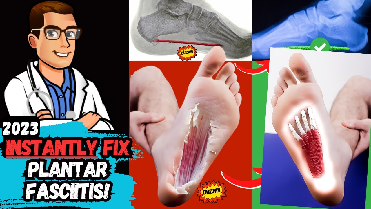 how to cure plantar fasciitis permanently heel pain heel spurs