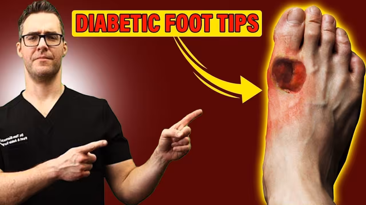 A Diabetics Worst Nightmare Foot Ulcers - Balance Foot & Ankle