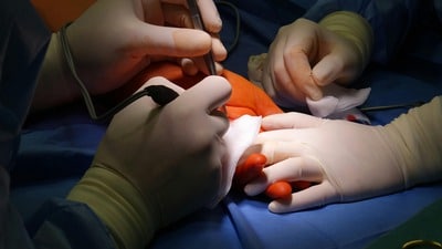 flat foot surgery recovery time