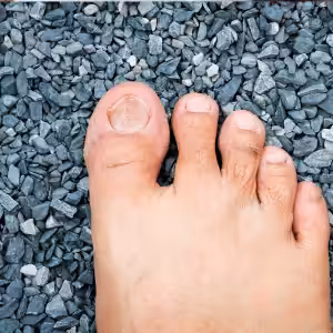 vertical nail ridges