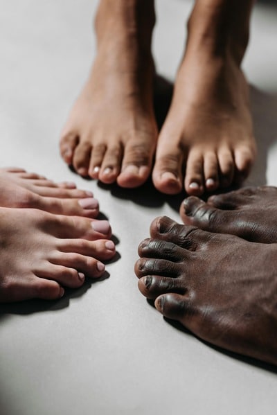 bunion big toe