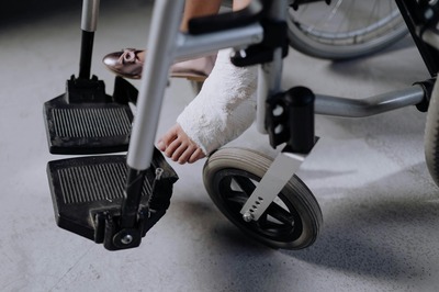 Can you walk after bunion surgery