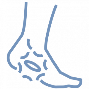 foot treatment