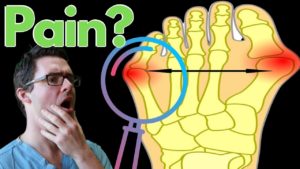 Podiatry Resources 1 Tailors Bunion Diagnosis