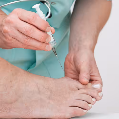 Cortisone Injections