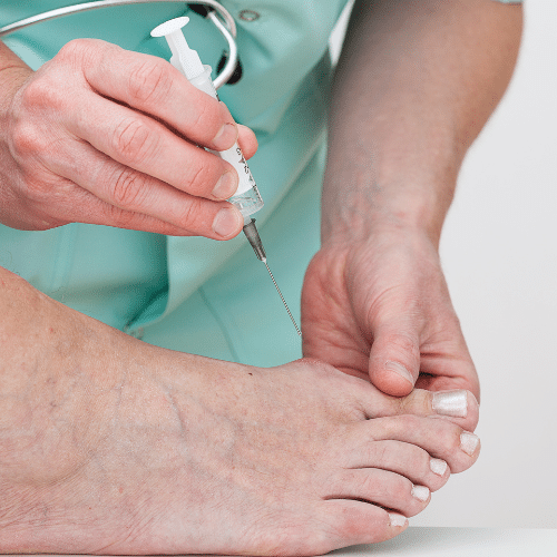 Cortisone Injections