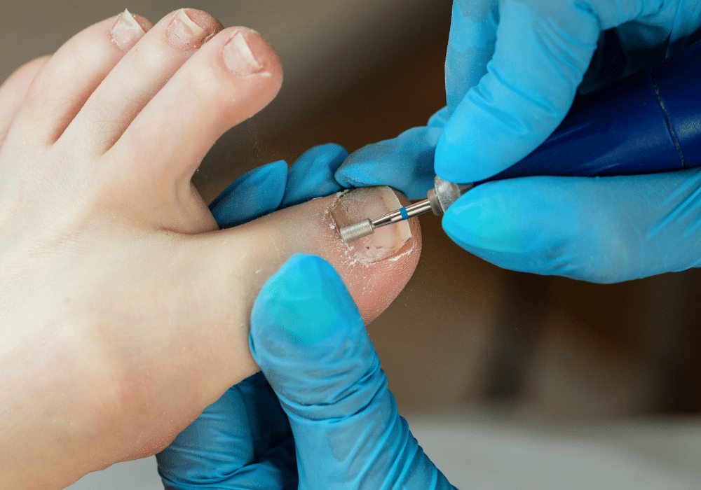 Callus & Nail Care 1 nail care