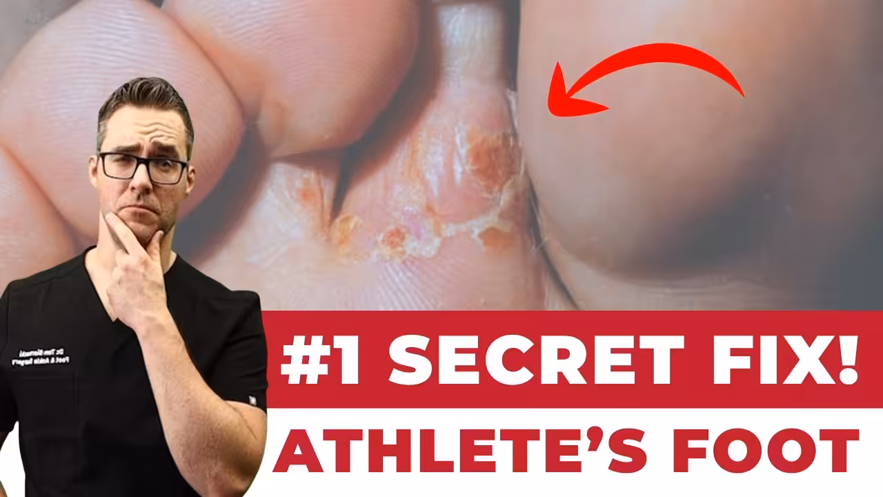 Foot Fungus 4 - Balance Foot & Ankle