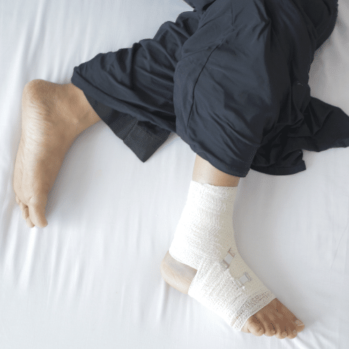 Fracture Repair Bloomfield 1 fracture repair near me