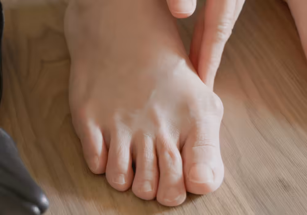 Hammertoe Correction 3 - Balance Foot & Ankle