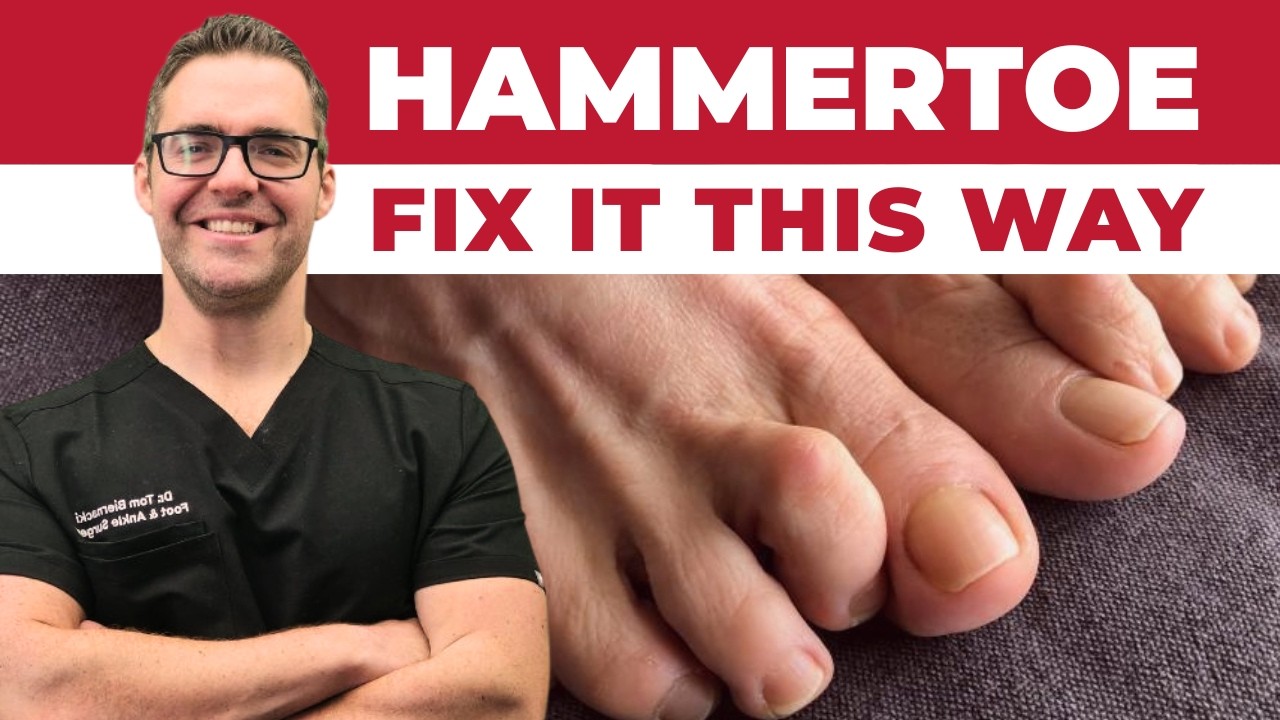 Hammertoe Correction | Balance Foot  Ankle