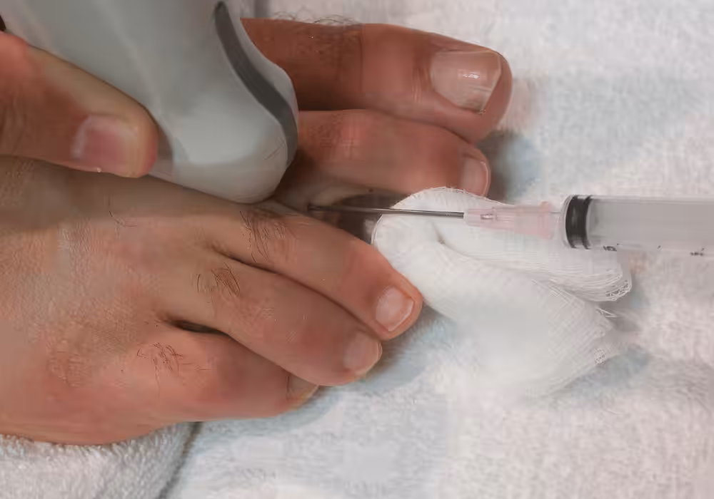 Neuroma Removal Near Me - Balance Foot & Ankle