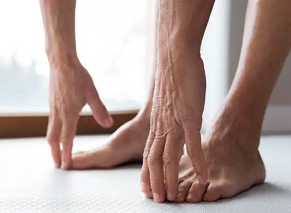 A Man Sitting On A Couch Examining A Cluster Of Fluid Filled Friction Blisters On The Ball Of His Foot Near The Big Toe - Balance Foot & Ankle
