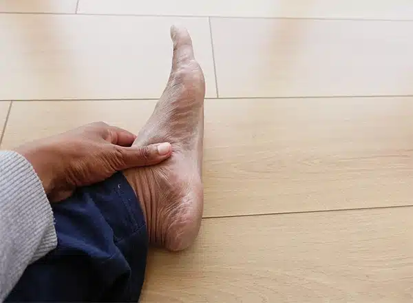 Bunion Hammertoe Treatment - Balance Foot & Ankle