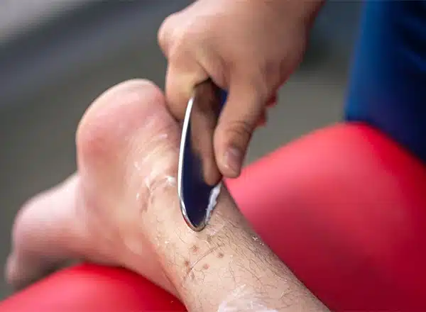 Circulation Vascular Testing