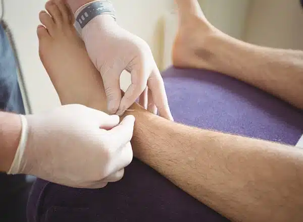 Diabetic foot wounds