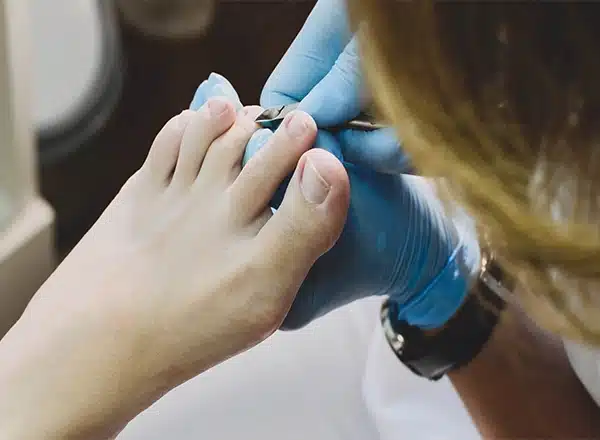 Safe Toenail Trimming Debridement