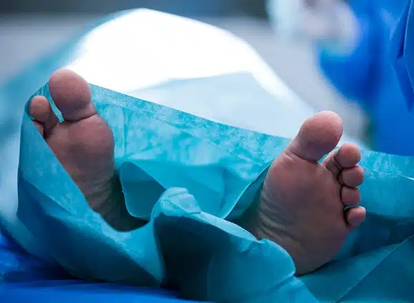 Surgery Rarely Needed