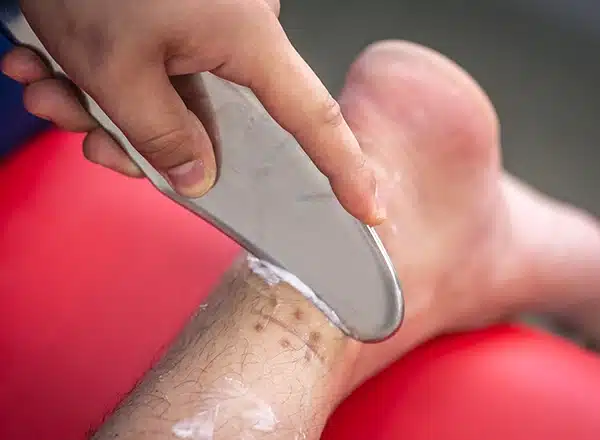 A close-up of a healthcare provider's hand applying a stainless steel instrument with topical cream for soft tissue mobilization on a patient's lower leg and Achilles tendon, set against a blurred red background.