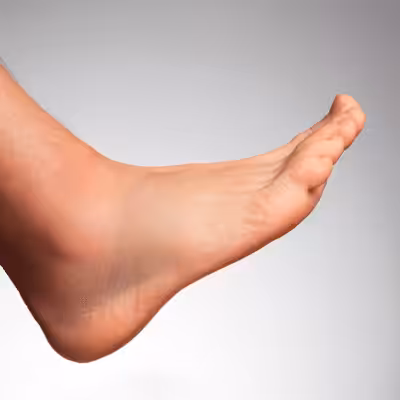 Foot Swelling - Balance Foot & Ankle