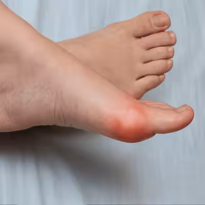 Lateral Ankle Pain 5 - Balance Foot & Ankle