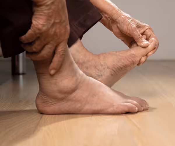 senior swollen foot