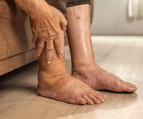 my foot is swollen