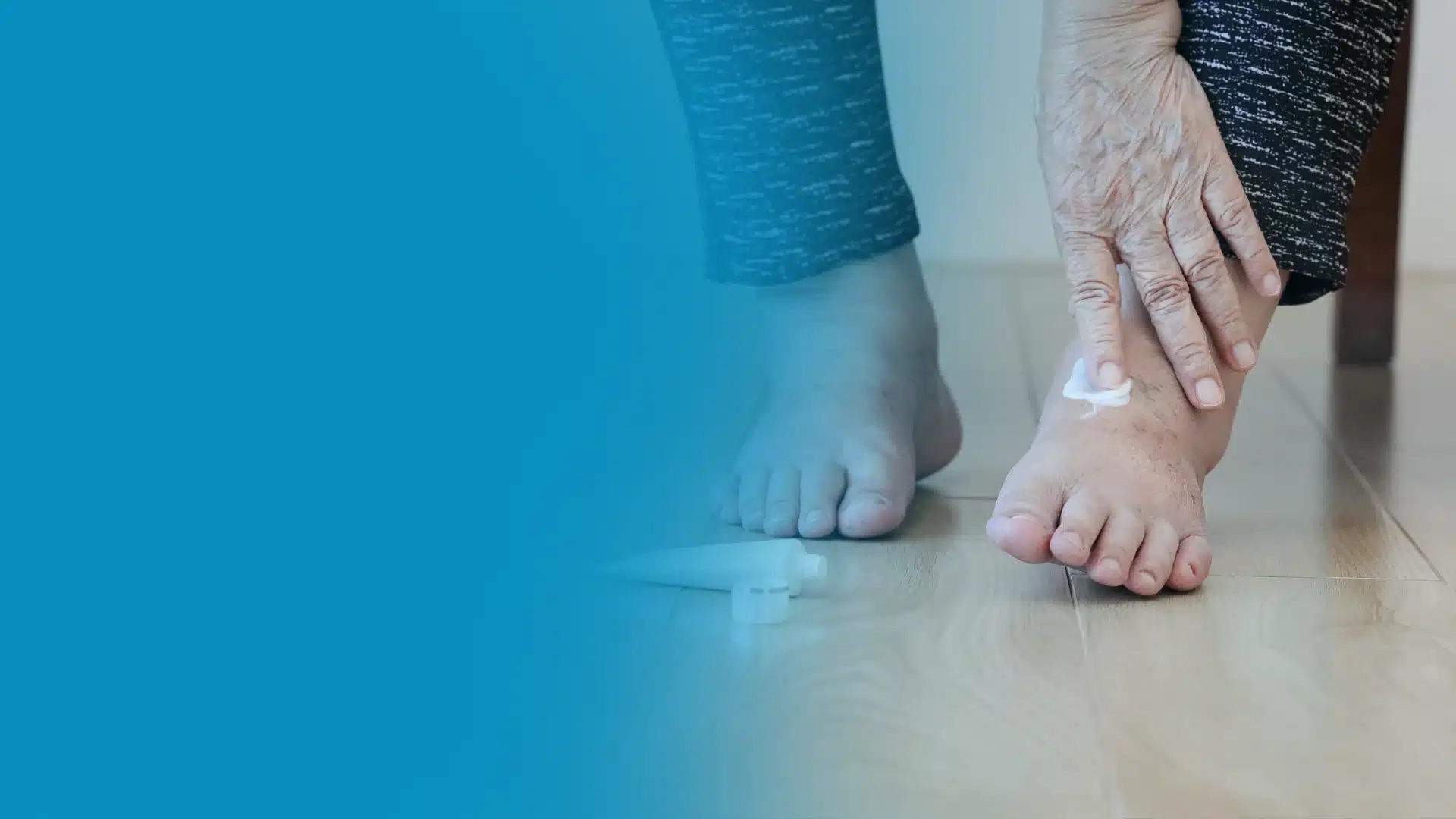 senior with swollen feet