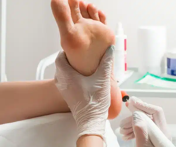 podiatrist consultation