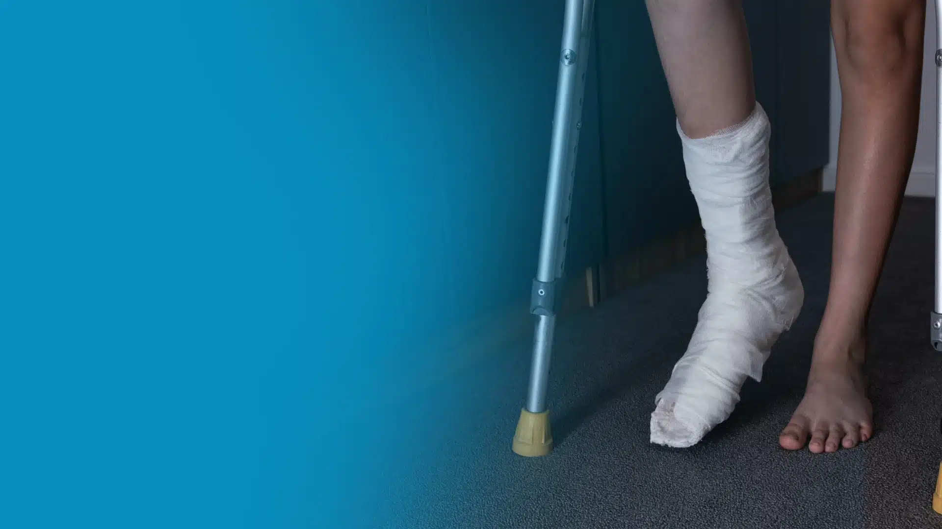 foot fracture