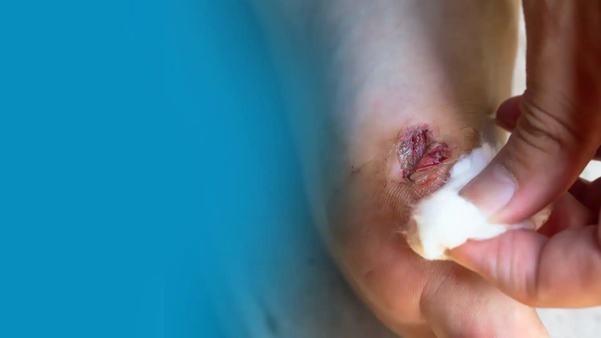 foot wound care