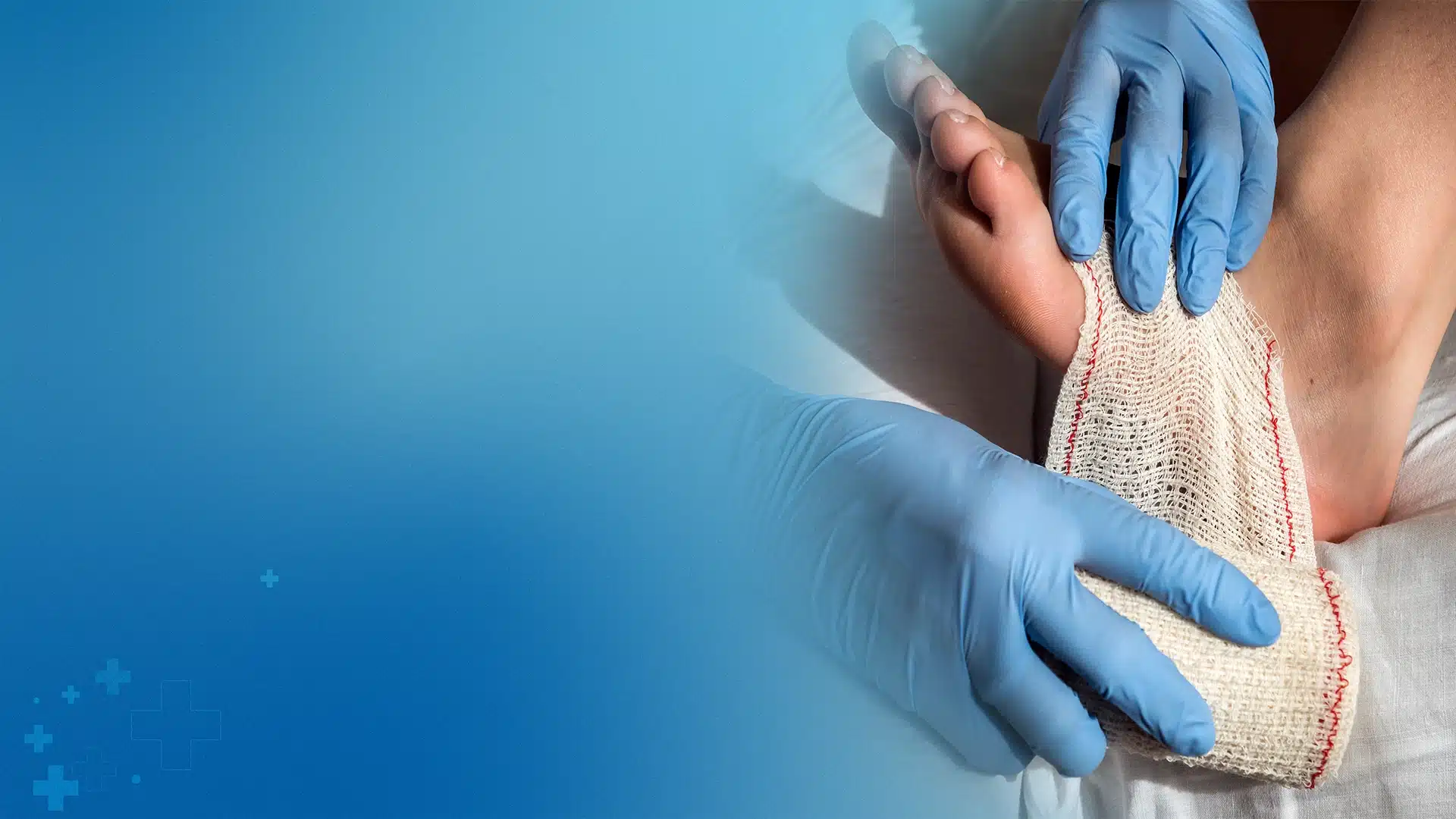 Utilizing advanced bandaging techniques to reduce swelling and promote rapid healing of foot wounds and sports injuries.