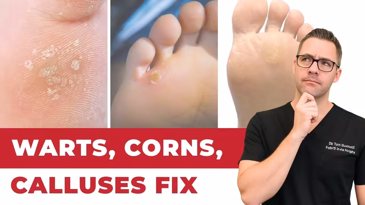 Senior Foot Callus Treatment | Balance Foot & Ankle