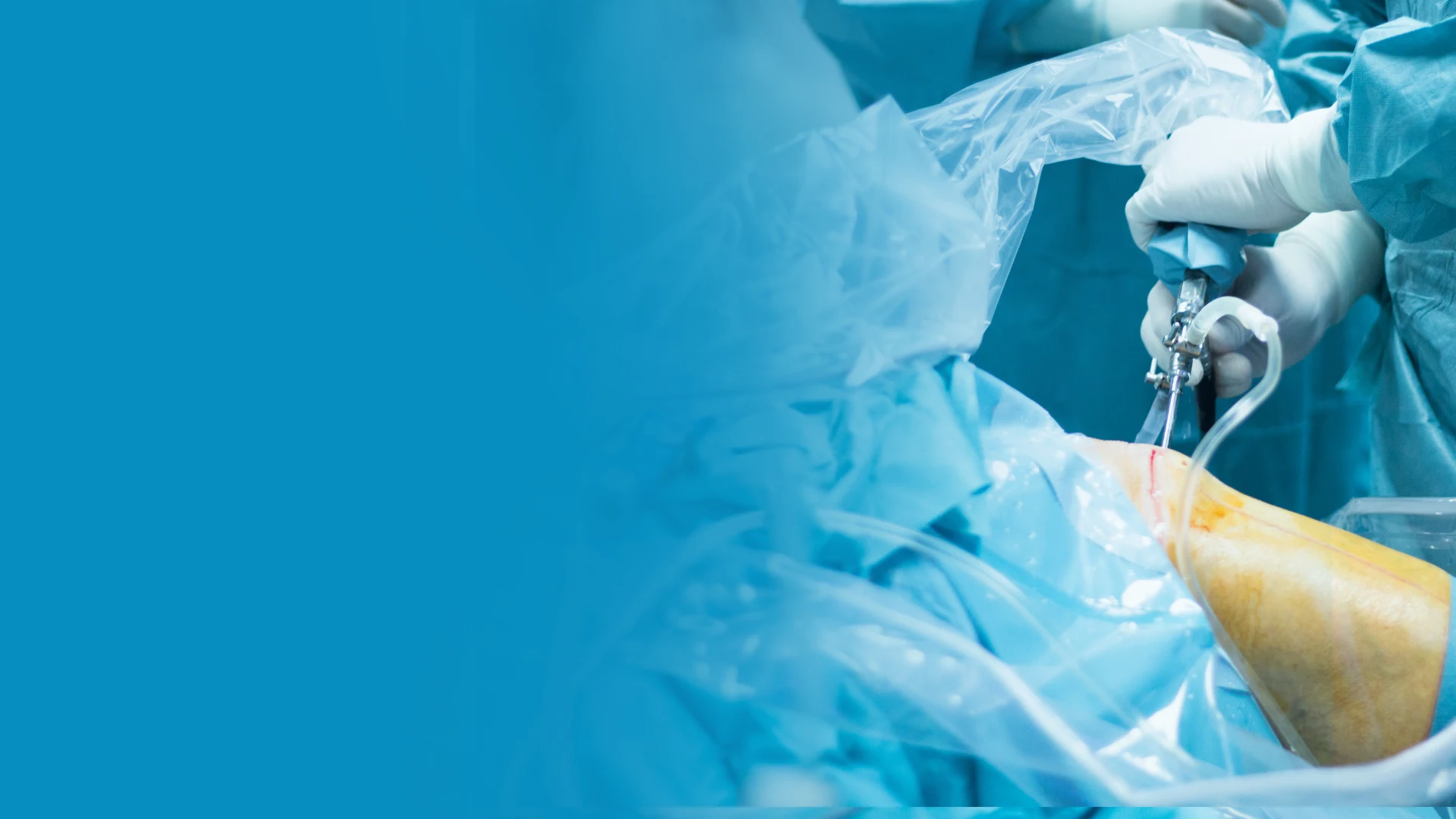 Minimally Invasive Ankle Arthroscopy