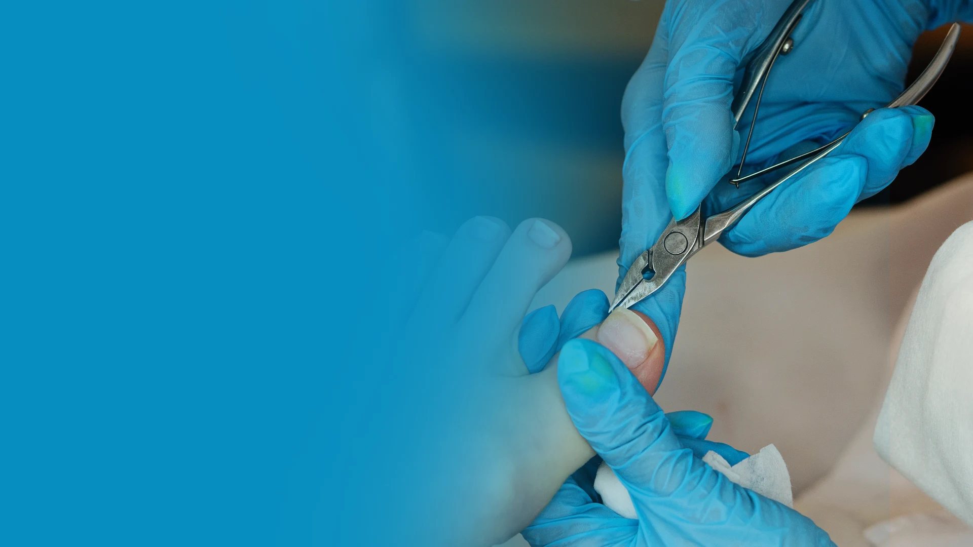 Toenail Matrixectomy