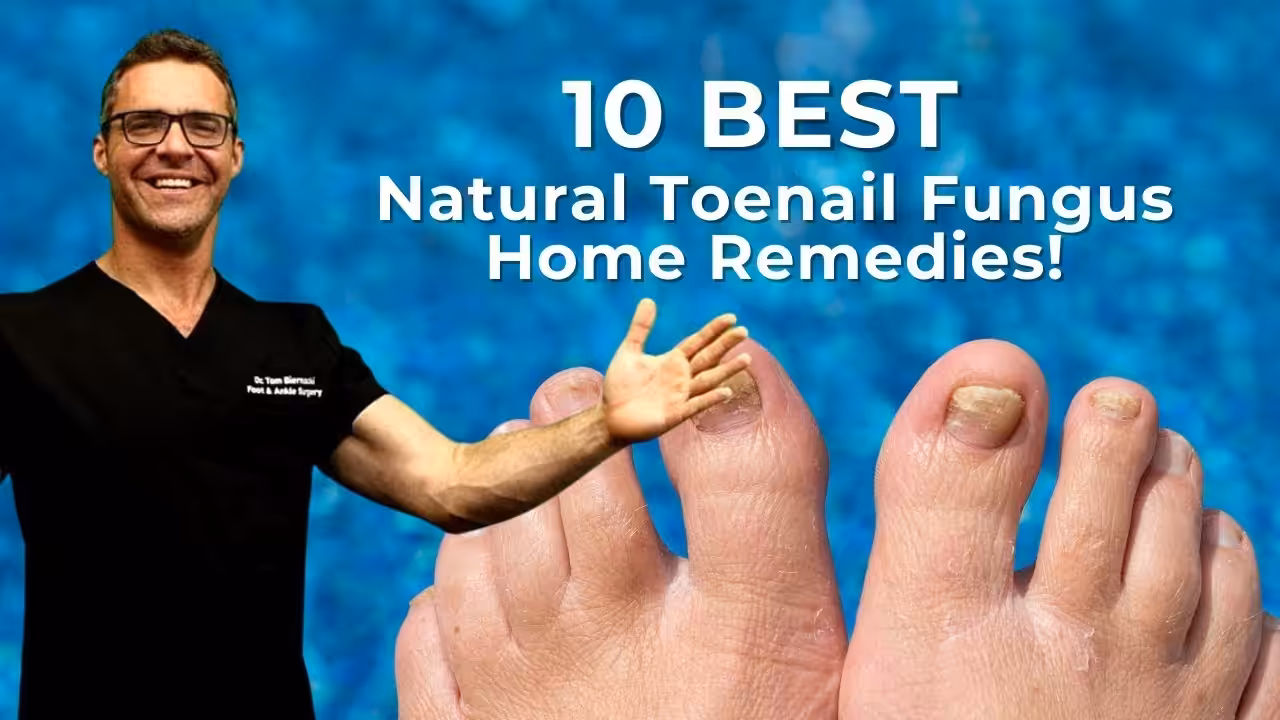 Ankle Sprain Treatment In Bloomfield Hills | Balance Foot & Ankle