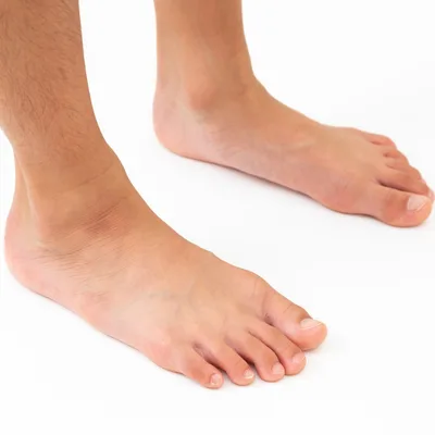 bunion treatment howell