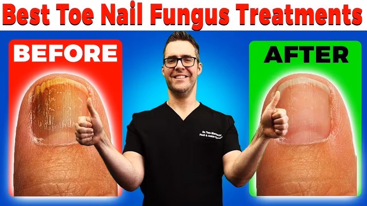 Toenail Fungus Treatment In Bloomfield Hills | Balance Foot & Ankle