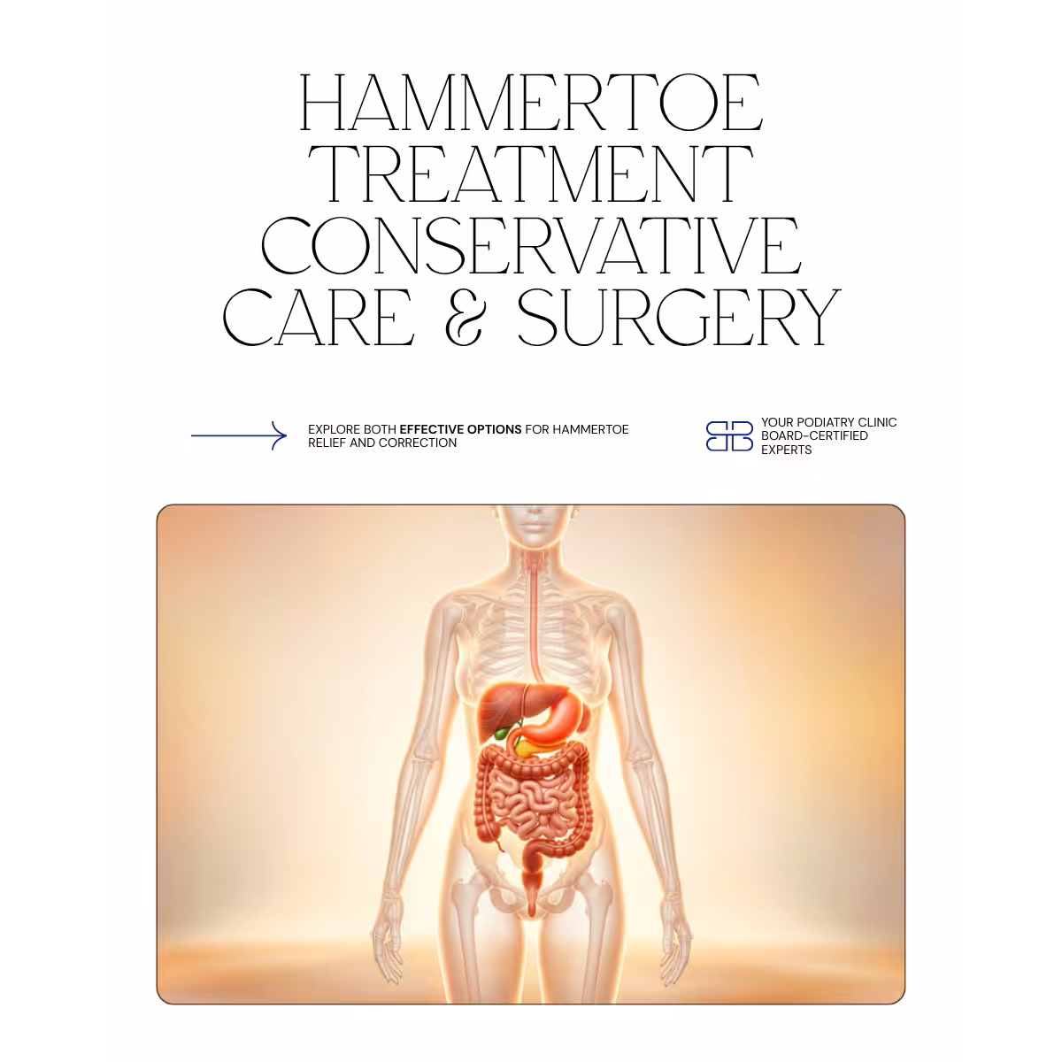 Hammertoe correction and treatment options at Balance Foot & Ankle podiatrist