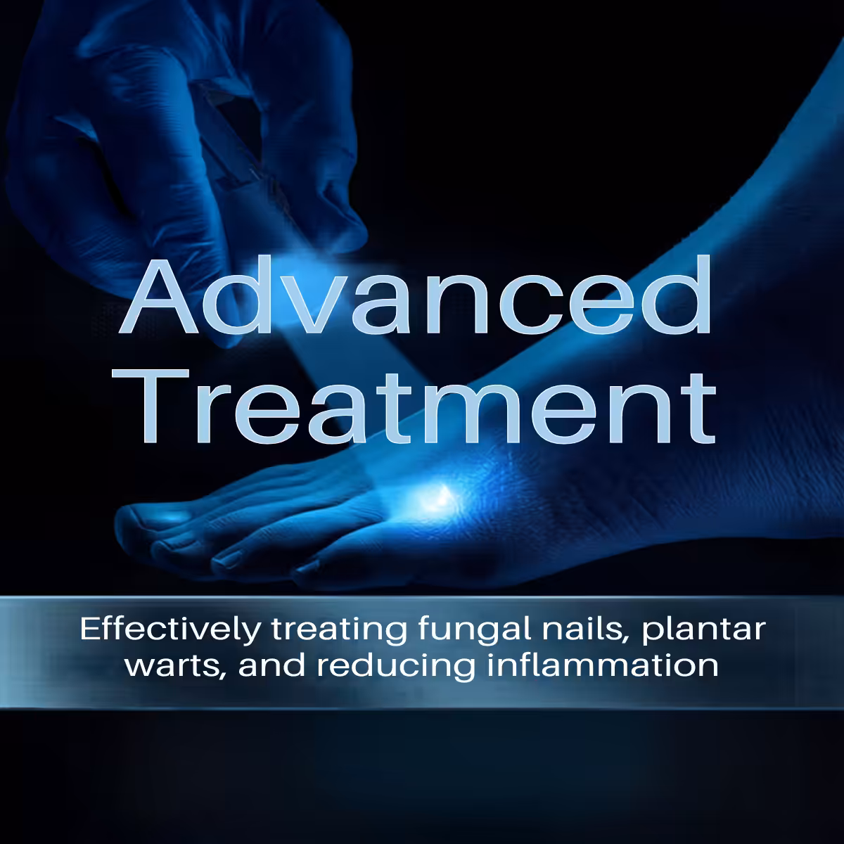 Laser therapy for plantar wart removal - Balance Foot & Ankle Michigan