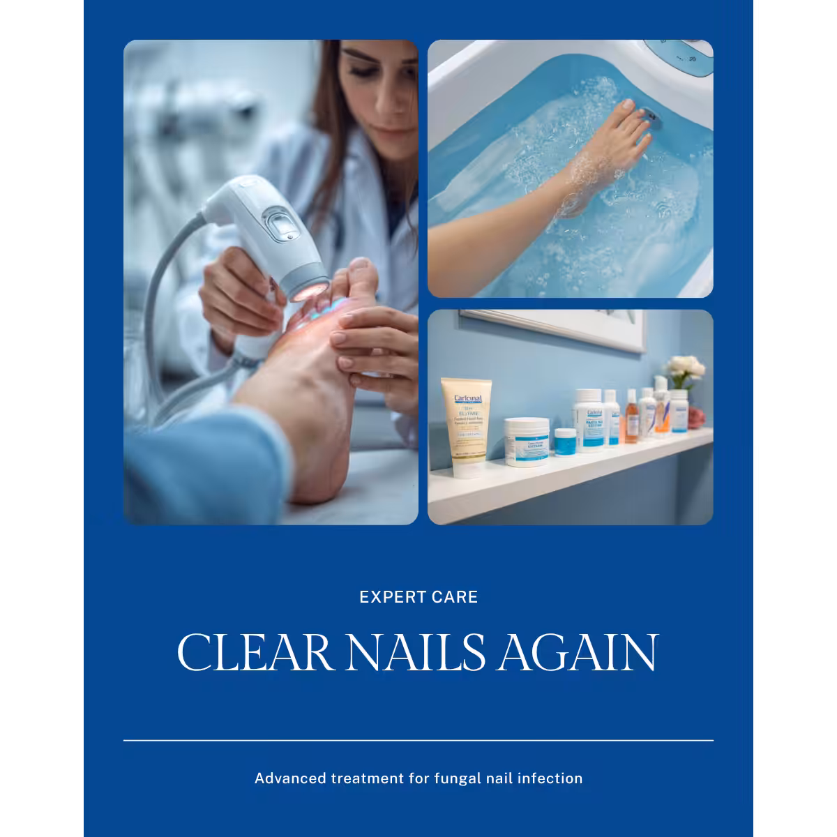 Toenail fungus treatment with laser therapy at Balance Foot & Ankle podiatry clinic