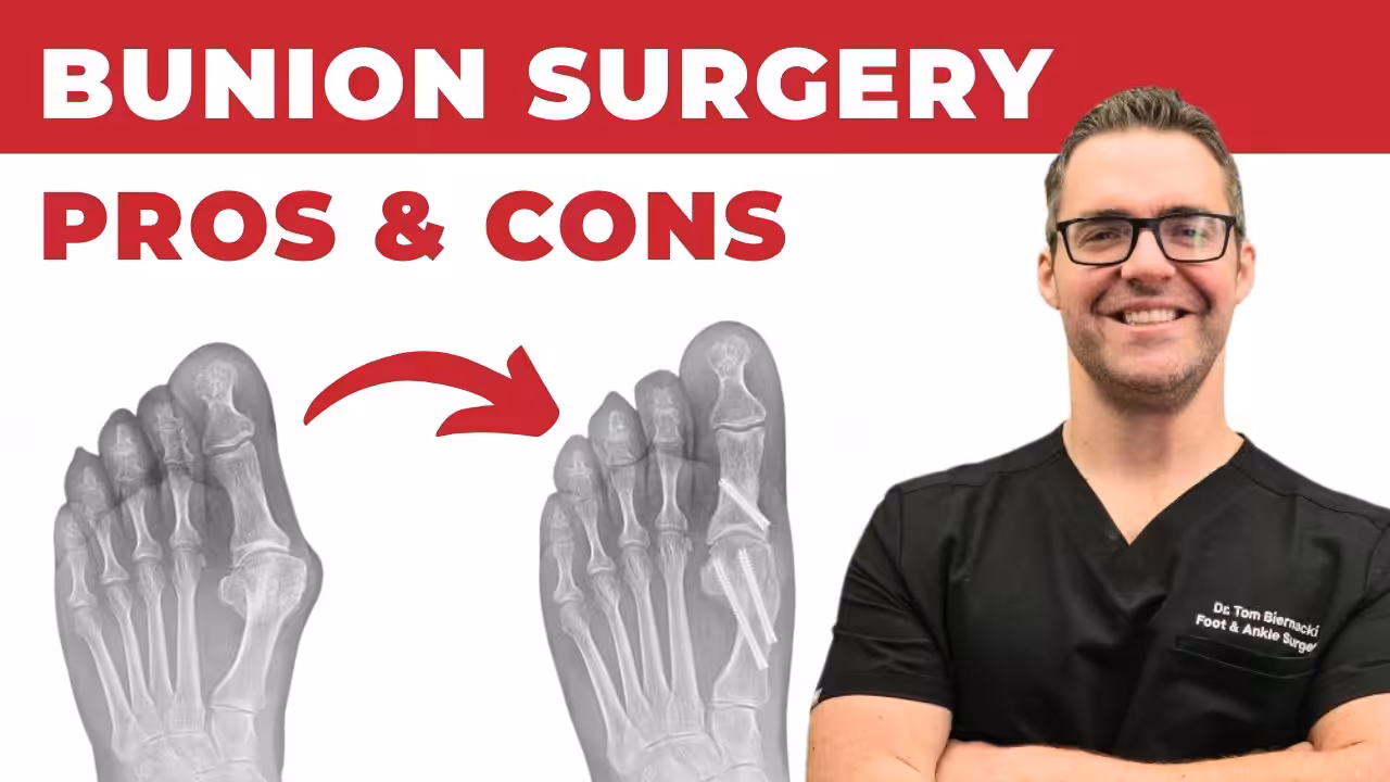 Bunion treatment evaluation at Bloomfield Hills Michigan podiatrist