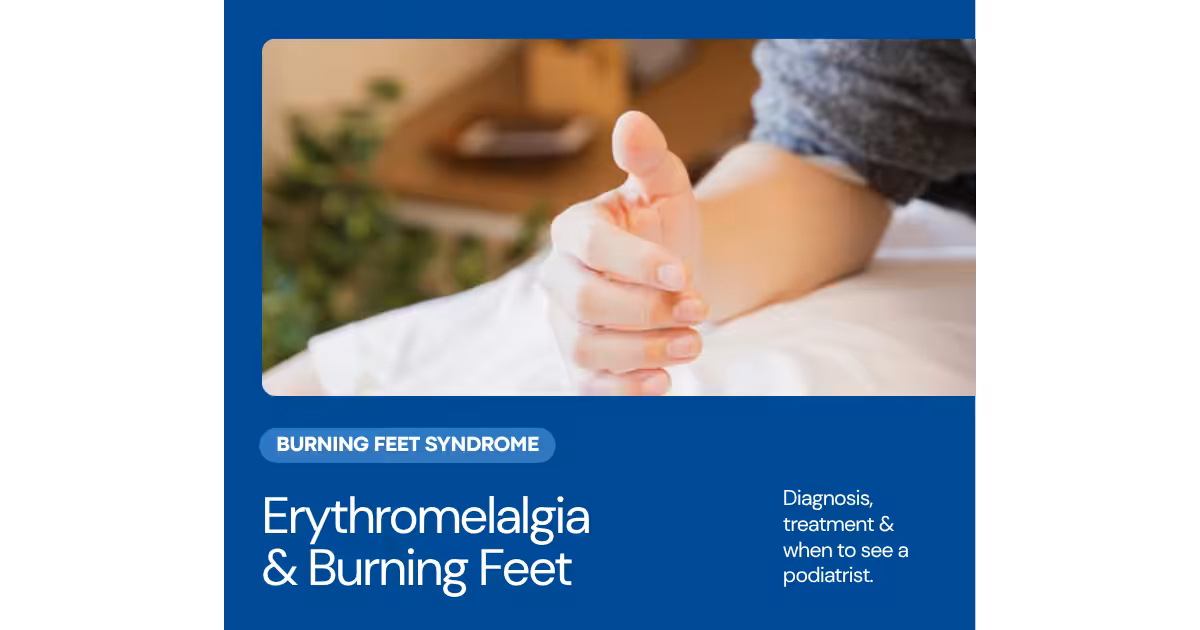 Erythromelalgia burning feet syndrome diagnosis treatment podiatrist Michigan
