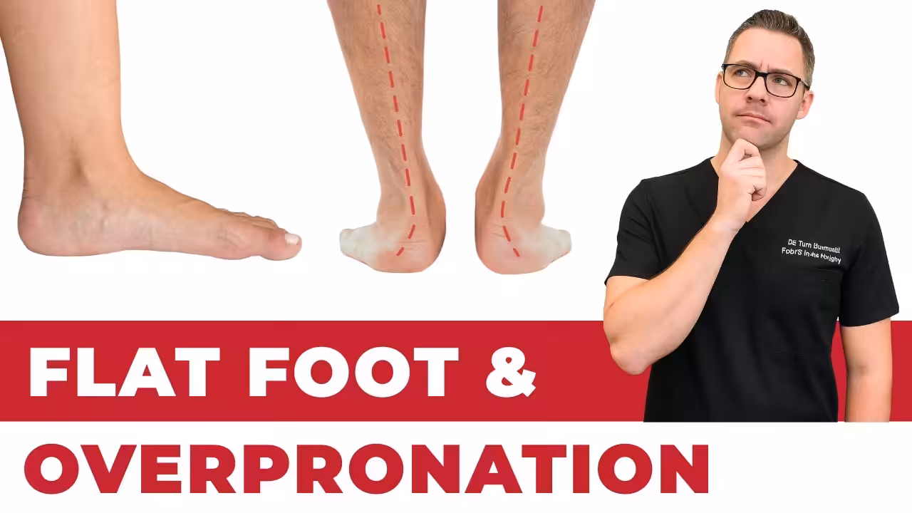 Flat feet treatment at Balance Foot and Ankle Howell Michigan office