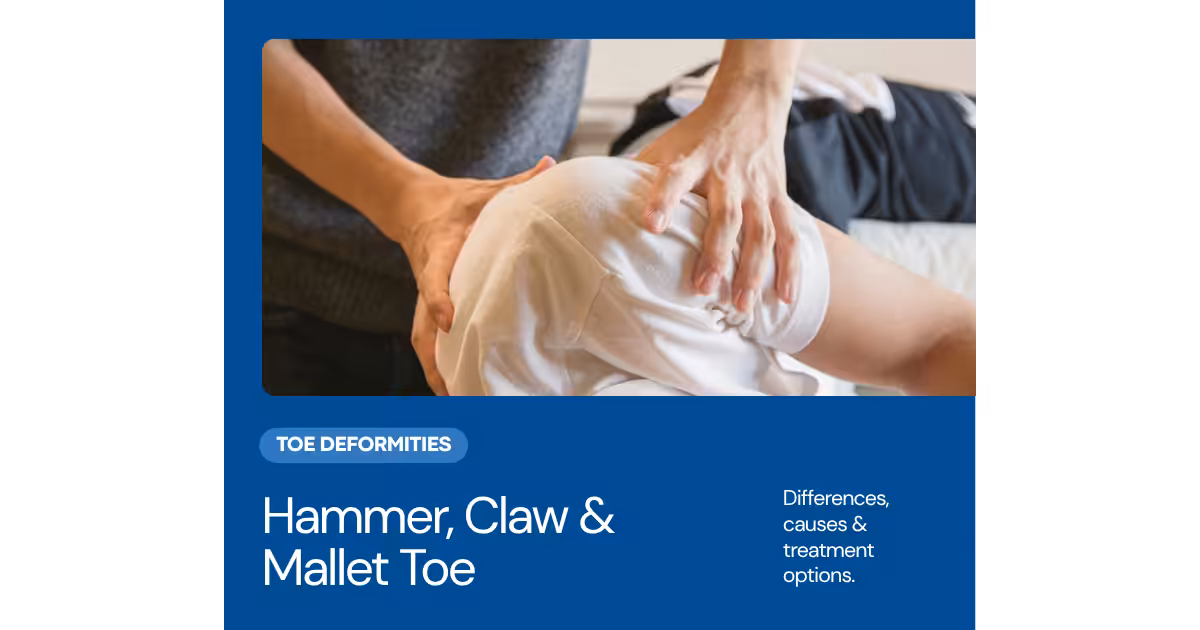 Hammer toe claw toe mallet toe differences treatment podiatrist Michigan
