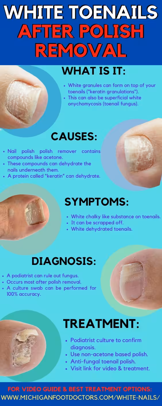 Keratin Granulations Infographic - Balance Foot & Ankle