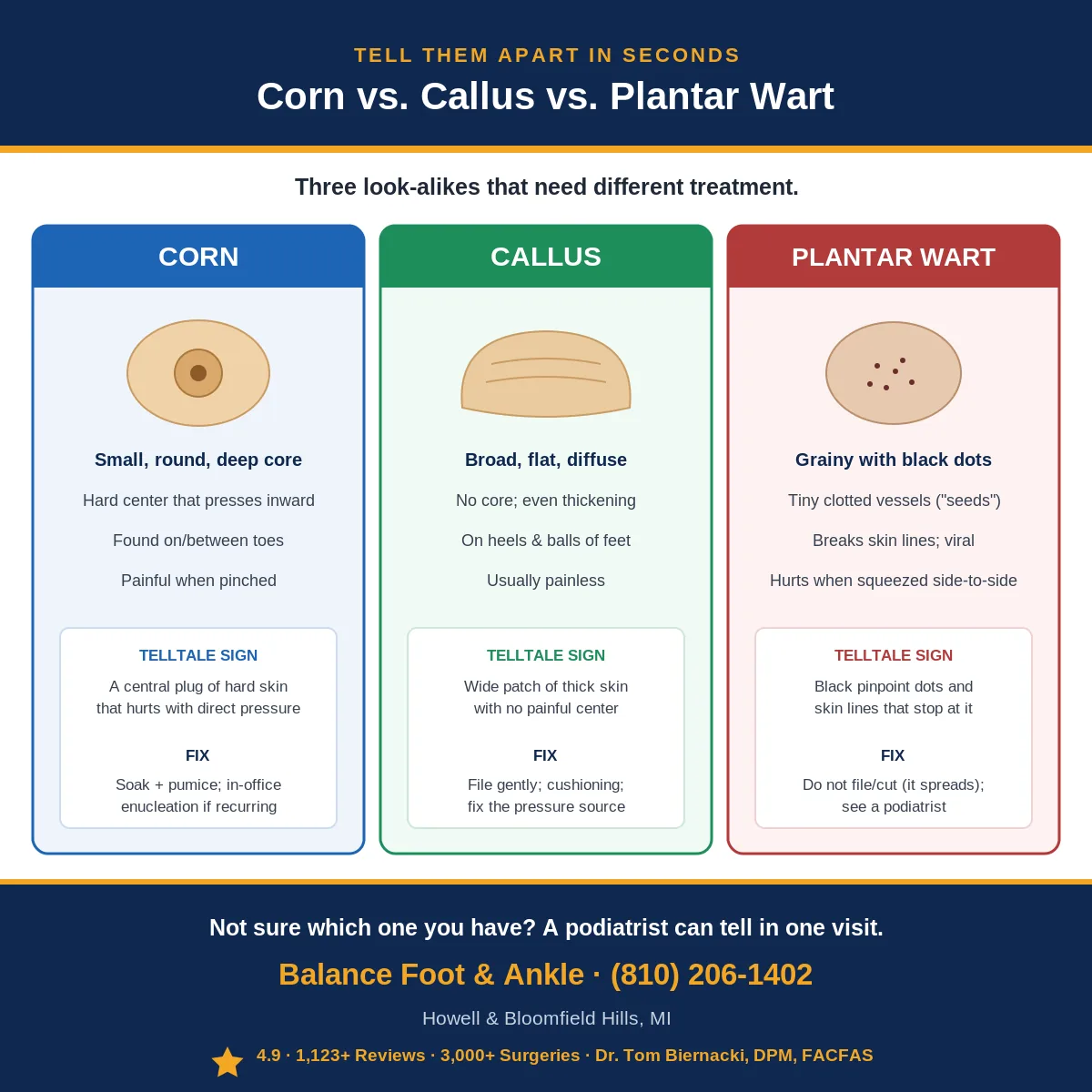 Corn vs callus vs plantar wart comparison chart - how to tell foot lesions apart, Balance Foot & Ankle Howell MI